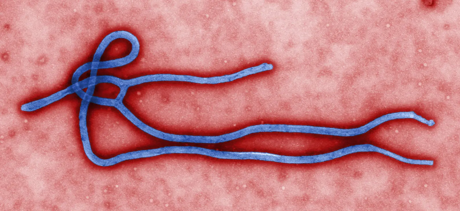 Quênia confirma primeiro caso importado de ebola, da cepa Bundibugyo